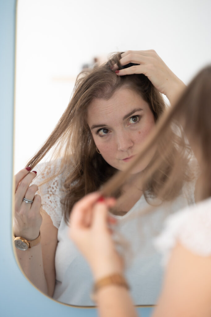 Thickening powder and alopecia